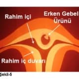 İşte Mucize