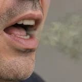 Ağız Kokusu Neden Olur? Kalıcı Kokunun Kaynağı Nasıl Araştırılır?