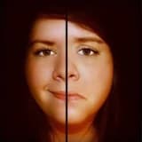 Bipolar Bozukluk - İki Uçlu Mizaç Bozukluğu