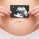Perinatoloji (maternal-fetal tıp) nedir ? İlgi alanları nelerdir? perinatal işlemler nelerdir?