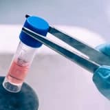 ÜROLOJİDE KÖK HÜCRENİN YERİ