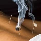 AKUPUNKTUR- MOXA - HOMEOPATi -BİTKİLER