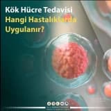 Kök Hücre Tedavisi Hangi Hastalıklarda Uygulanır?