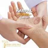 Karpal Tünel Sendromu Nedir? Tedavisi Nasıl Yapılır?