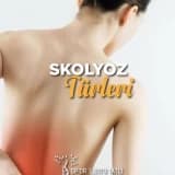 Skolyoz Türleri