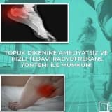 Topuk dikenine ameliyatsız ve hızlı tedavi radyofrekans yöntemi ile mümkün!