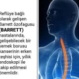MİDE KANSERİNDE RİSK FAKTÖRÜ