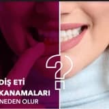 Diş eti kanaması neden oluşur?