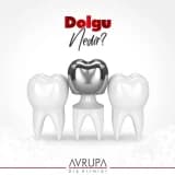 Dolgu Nedir?