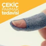 ÇEKİÇ PARMAK TEDAVİSİ