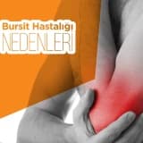 Bursit Hastalığı Nedenleri
