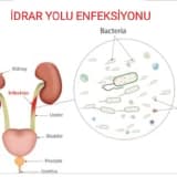 ÜRİNER SİSTEM ENFEKSİYONLARI