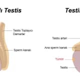Testis Kanseri Hakkında Bilgilendirme