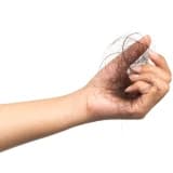 Saç Dökülmesi (Alopesi)