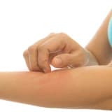 Kaşıntı nedenleri (pruritus)