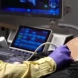 Detaylı Ultrason Hakkında Merak Edilenler