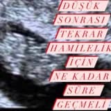 Düşük Sonrası Hamilelik İçin Ne Kadar Süre Geçmeli?