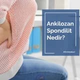 Ankilozan Spondilit Nedir?