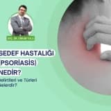 Sedef Hastalığı (Psoriasis) Nedir?