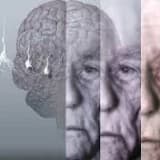 Deliryum Nedir?
