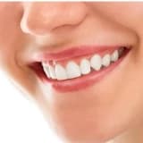 Zirkonyum Ve Estetik Tedaviler