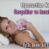 Liposuction nedir? gerçekler ve hurafeler