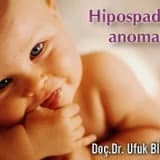 Hipospadias anomalisi