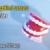 Diş çekimi sonrası önerileri