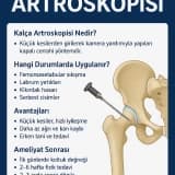 Kalça Artroskopisi. Hangi Durumlarda Uygulanır? Avantajları, İyileşme süresi, Rehabilitasyonu