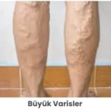 Varis Dereceleri