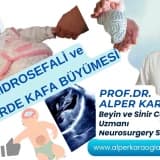 Akut HİDROSEFALİ ve BEBEKLERDE (YENİDOĞANDA) KAFA BÜYÜMESİ | Prof.Dr. Alper KARAOĞLAN