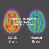 DEHB'in (Dikkat Eksikliği ve Hiperaktivite Bozokluğu) bilinmeyen tarafları, DEHB ile yaşamak