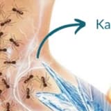 Diyabetik Ayak Sendromu Semptomları