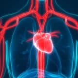 Stent mi, Bypass mı?