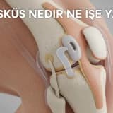 Menisküs Nedir Ne İşe Yarar?
