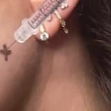 Botoks tedavisi ile diş sıkmanın önüne geç