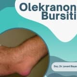 Olekranon Bursiti