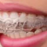 DİŞ SIKMA (BRUKSİZM)