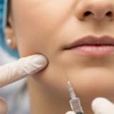 Masseter Botoks ile Diş Sıkma Tedavisi