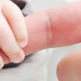 Prematüre doğum nedir?