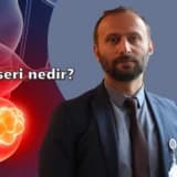 Mesane kanseri nedir?