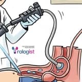 SİSTOSKOPİ | NEDİR, NE ZAMAN YAPILIR, KORKMALI MIYIZ?