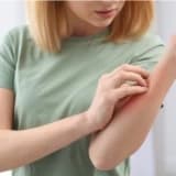 Yaz mevsiminde en sık görülen 6 alerji