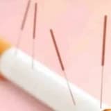 Sigarayı Bırakmaya Akupunturun Etkisi