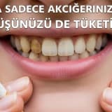 "Sigara Sadece Akciğerinizi Değil, Gülüşünüzü De Tüketiyor"