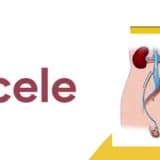 Varikosel: Sessizce İlerleyen ve Erkek Fertilitesini Tehdit Eden Damar Sorunu