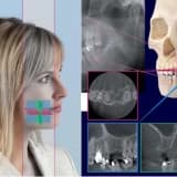 Dental Tomografi Nedir?
