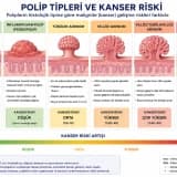 Kolon Polipleri Kansere Dönüşür mü? Hangi Polipler Risk Taşır?