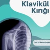 Klavikül Kırığı