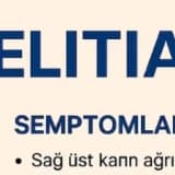 KOLELİTİAZİS (SAFRA KESESİ TAŞI) Hasta Bilgilendirme Metni